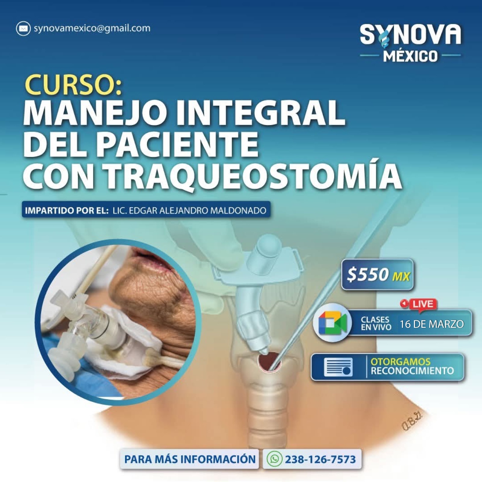 Traqueostomía